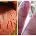 16 Signs You May Have HIV - MUST READ
