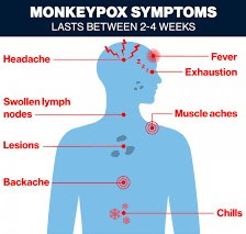 Monkeypox: How is monkeypox transmitted, Signs and symptoms