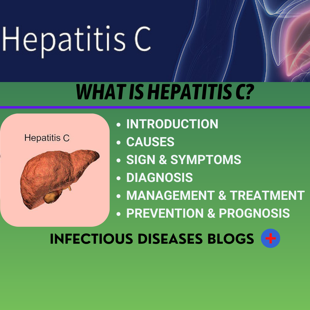 What is Hepatitis C?