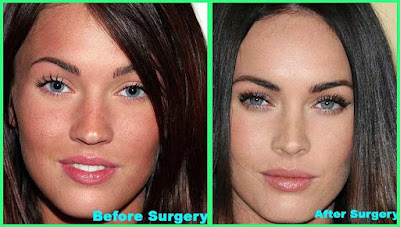 Megan Fox Nose Job