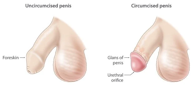 Cut Vs Uncut Type Penis