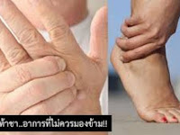 มือชา เท้าชา บ่อย ๆ รีบหาหมอด่วน อย่านิ่งนอนใจ