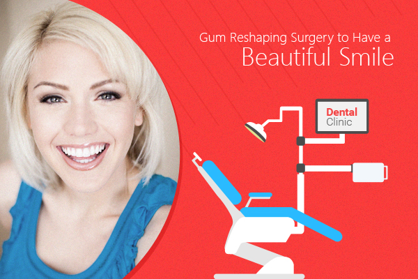 Gum Reshaping Surgery to Have a Beautiful Smile