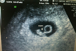 Baby 7 Week Ultrasound