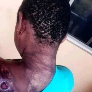 Photos: Heartless woman poured hot water mixed with pepper on 10 years old maid (2)