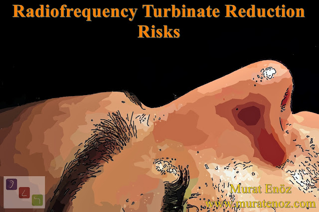 Turbinate Radiofrequency Complications - Turbinate Radiofrequency Risks - Radiofrequency Turbinate Reduction Complications