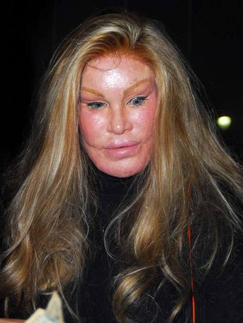 jocelyn wildenstein 2010. jocelyn wildenstein 2010.