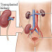 Mediterranean diet can safeguard kidneys health in transplant recipients: Study