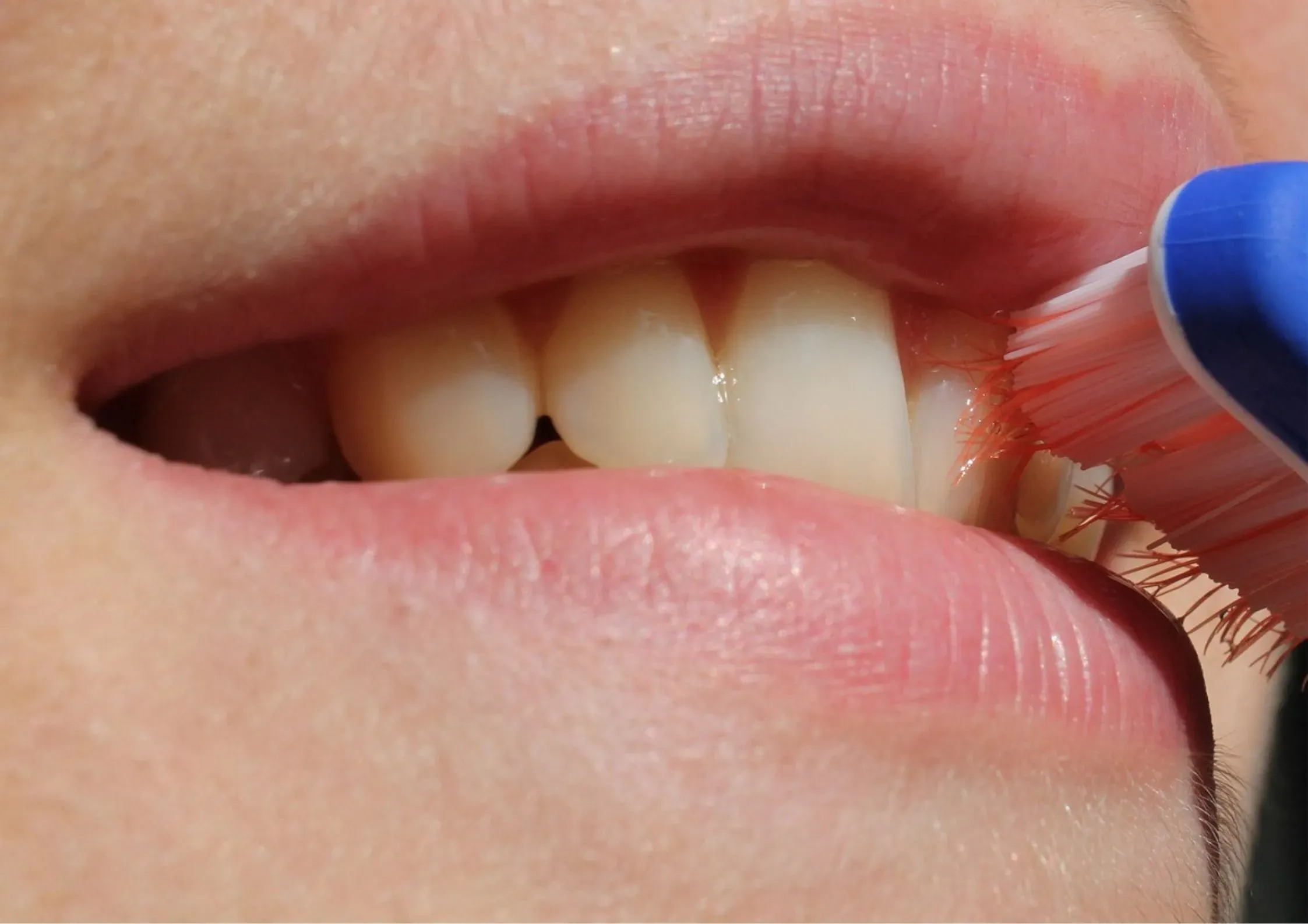 Kapan Waktu Yang Tepat Untuk Menyikat Gigi Saat Puasa? Berikut Penjelasannya