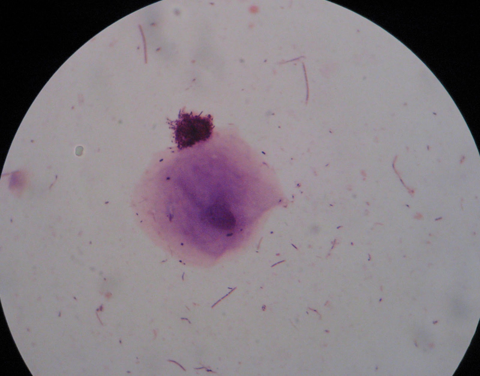 DVC Microbiology 146 Fall 11 (Gard): Lab 35: Oral Microbiota