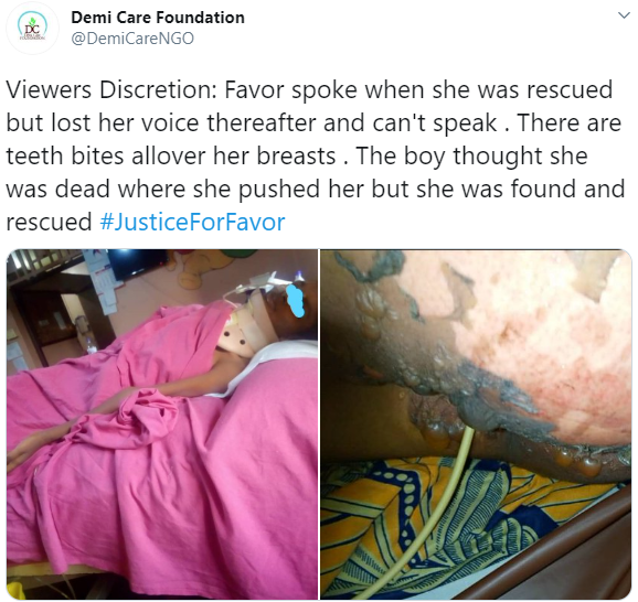 Teenager left with spinal cord injury after she was violently beaten up and raped by same man who allegedly raped her few months ago(photos)
