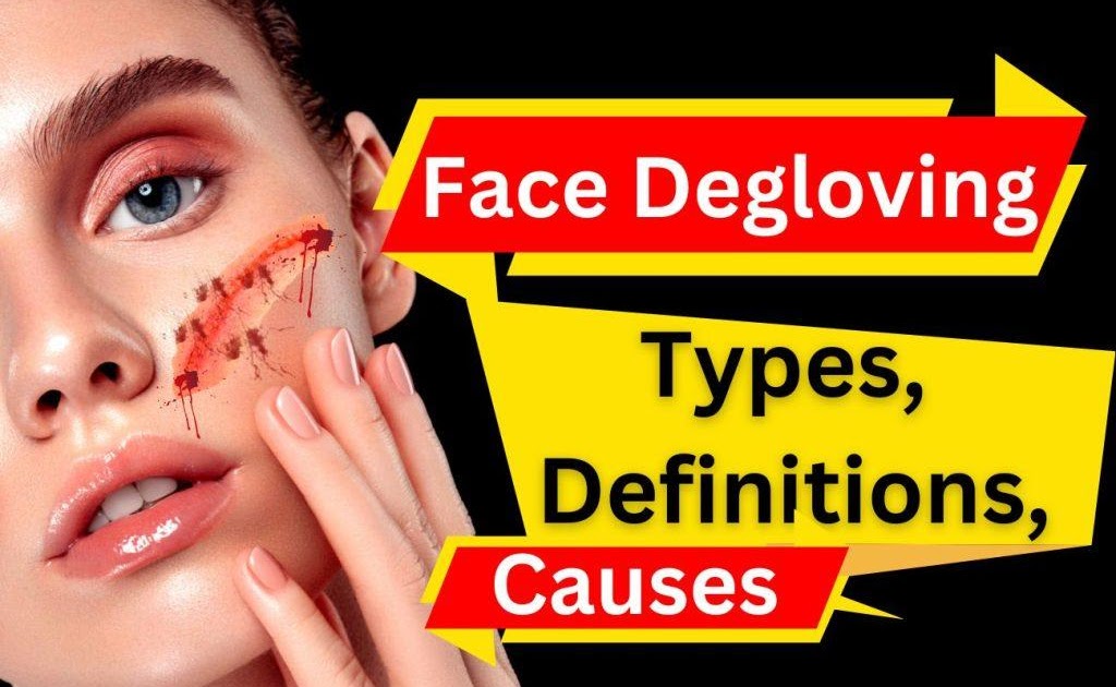 Degloved Face Face Avulsion Degloved Face Causes Types