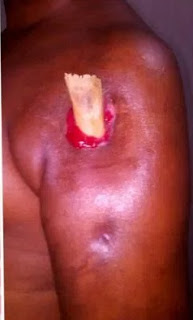  Oh My God! See Strange Disease Traumatize 16 Year Old Boy