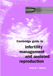 Guide to Infertility Management and Assisted Reproduction