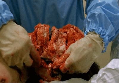 gif dissection gore dans EBOLA SYNDROME