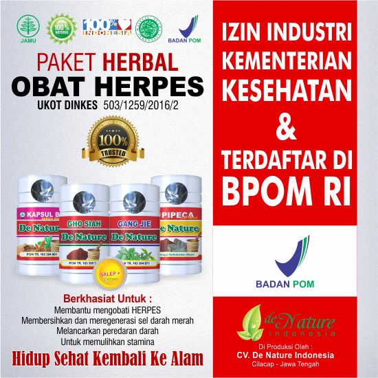 cara menyembuhkan herpes