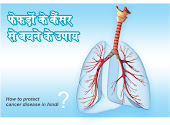 फेफड़ों के कैंसर से बचने के उपाय ways to prevent lung cancer in hindi, अनदेखी मत कीजिए do not ignore in hindi, लंबे समय तक खांसी की समस्या को अनदेखी मत कीजिए Do not ignore the problem of cough for a long time in hindi, खांसी से खून आना इसे अनदेखी मत कीजिए coughing up blood don't ignore it in hindi, छाती में दर्द को अनदेखी मत कीजिए don not  ignore chest pain in hindi, सांस लेने में परेशानी को अनदेखी मत कीजिए Do not Ignore difficulty breathing in hindi, गले का बैठना इसे अनदेखी मत कीजिए sore throat don't Ignore It in hindi, वजन का कम होना को अनदेखी मत कीजिए do not Ignore weight loss in hindi,  अस्थमा को अनदेखी मत कीजिए do not Ignore asthma in hindi, फेफड़ों के कैंसर से दूर रखता है keeps you away from lung cancer in hindi, चिया सीड्स कैंसर से दूर रखता है chia seeds keep cancer away in hindi, मक्की कैंसर से दूर रखती  है corn keeps cancer away in hindi, बादाम कैंसर से दूर रखता है almond keeps cancer away in hindi,  ओट्स कैंसर से दूर रखता है oats keep cancer away in hindi, चना कैंसर से दूर रखता है chana keeps cancer away in hindi, लंग कैंसर से दूर रहना है तो खाएं eat if you want to stay away from cancer in hindi, राजमा कैंसर से दूर रखता है rajma keeps cancer away in hindi, मुलेठी कैंसर से दूर रखता है liquorice keeps cancer away in hindi, कंटकारी-भटकटैया कैंसर से दूर रखता है kankkari-wandering keeps away from cancer in hindi, तुलसी कैंसर से दूर रखता है tulsi keeps cancer away in hindi, आयुर्वेदिक लंग कैंसर का काल है ayurveda have the power to remove lung cancer in hindi, लहसुन कैंसर से दूर रखता है garlic keeps cancer away in hindi, मुनक्का कैंसर से दूर रखता है dry grapes keep cancer away in hindi, एचिनासा कैंसर से दूर रखता है echinacea keeps cancer away in hindi, हेल्थी डाइट का सेवन करना consuming healthy diet in hindi,  व्यायाम करना exercising in hindi, आयुर्वेद लाइफस्टाइल बीमारियों से रखे दूर ayurveda Lifestyle keep away from diseases in hindi,  sakshambano, sakshambano ka uddeshya, latest viral post of sakshambano website, sakshambano pdf hindi,