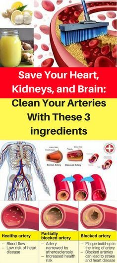 Save Your Kidneys, Heart And Brain: Clean Your Arteries Using Only 3 Ingredients