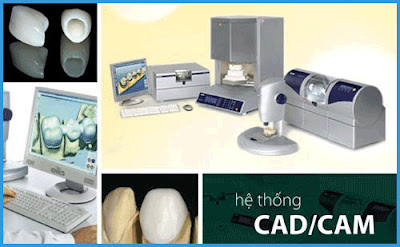 Trồng Răng Sứ giá bao nhiêu tiền - Hệ thống CAD/CAM