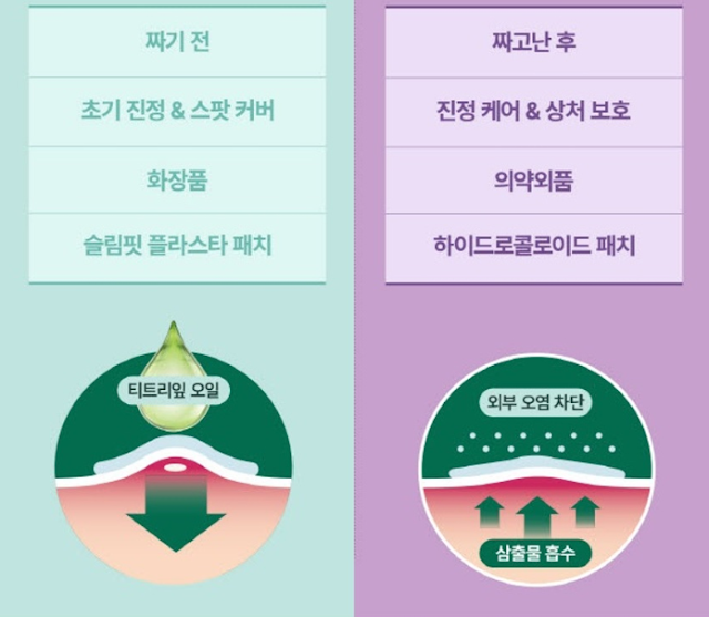 다이소 마데카21 여드름패치 전후