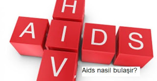 Aids hastalığı nasıl bulaşır?