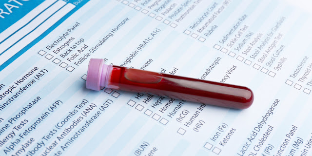 Important of Blood Testing