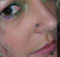 body piercings, Piercing a nose, nose keloid as a result of piercing, how long does a nose piercing take to close up, how to make a nose piercing invisible, Puncture of a wing of a nose