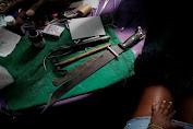 Tabib di Kuba Operasi Pasien Pakai Golok hingga Palu