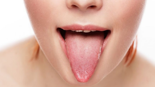 The Color of The Tongue That Describes Children Health