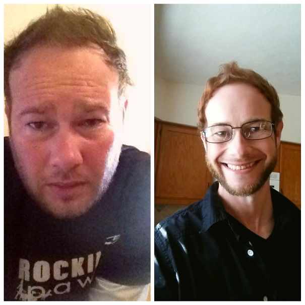 10+ Before-And-After Pics Show What Happens When You Stop Drinking - My Last Day As An Alcoholic 8.18.14 Celebrating 2 Years 2 Months And 20 Days Sober