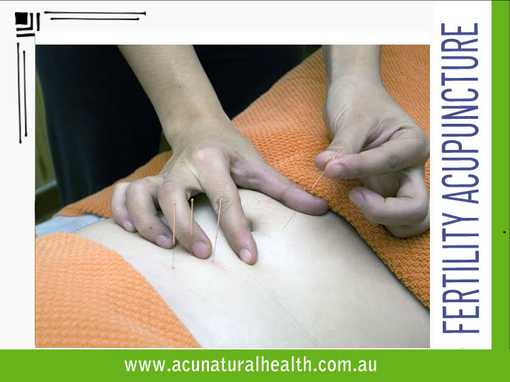 Fertility Acupuncture Brisbane