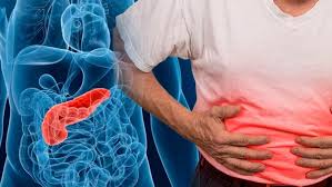 DOLOR INTENSO EN EL PANCREAS