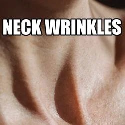 Neck wrinkles. Suprasternal notch and neck of the crop person