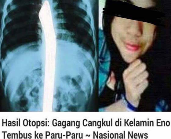 Kronologi Gadis Dibunuh Kejam, Dijolok Batang Cangkul Hingga Maut Di Indonesia