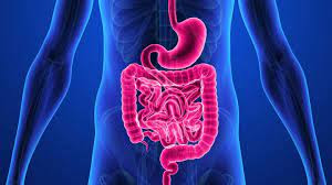 Understanding Crohn's Disease: A Comprehensive Overview