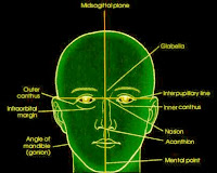 skull radiography landmarks