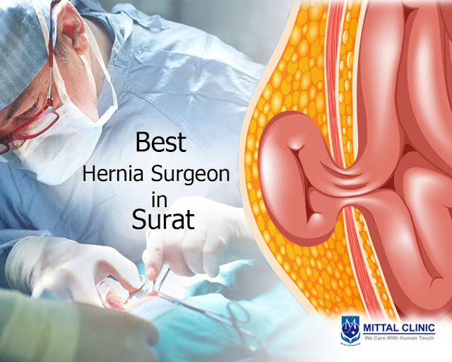 Best hernia surgeon in Surat