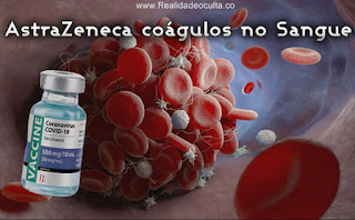 astraZeneca coagulos sangue