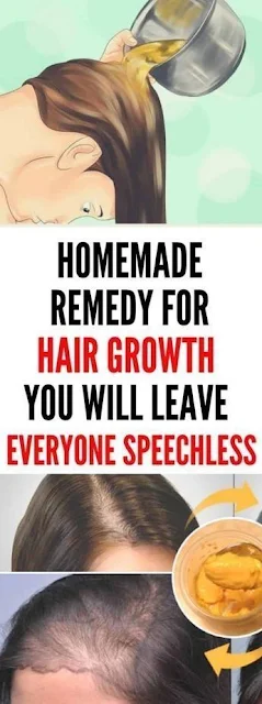 Homemade Remedy For Hair Growth. You Will Leave Everyone Speechless