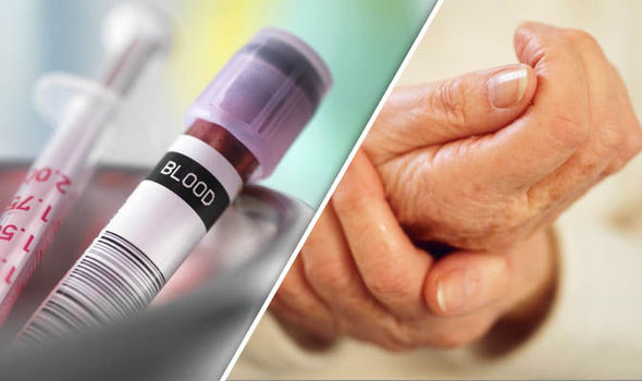 Predict whether you’ll get arthritis with this TEST 