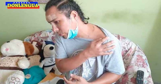 EN PERÚ | Su mejor amigo de la infancia lo desfiguró con una botella rota