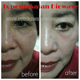 Testimoni Setrika Wajah Biowave Skincare