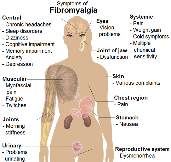 The Cure to Fibromyalgia Your Doctor Doesn’t Want You To Know