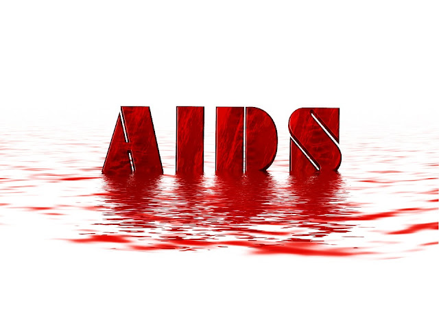 hiv aids,hiv,aids