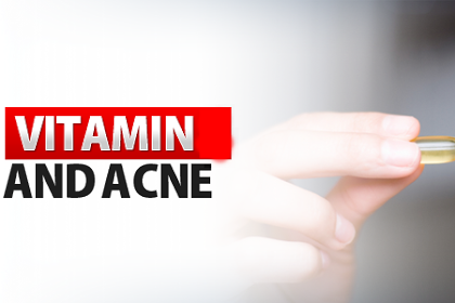 Acne and Vitamin Supplements 