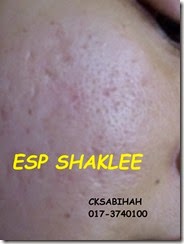 ESP