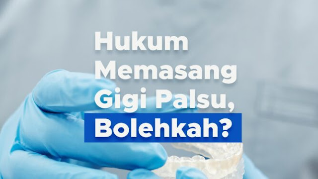 Bolehkah Memasang Gigi Palsu? Ini Penjelasannya