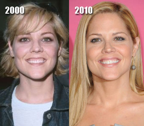 Nicole Kidman Lips Before And After. Mary McCormack efore and