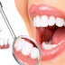 Bọc răng sứ thẩm mỹ trong trường hợp nào?