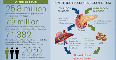 signs and symptoms of diabetes, signs of diabetes in women, diabetes symptoms in men, diabetes symptoms in women, type 1 diabetes, type 2 diabetes